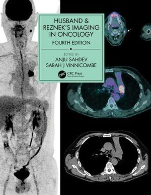 HUSBAND & REZNEK'S IMAGING IN ONCOLOGY