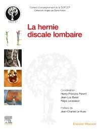 LA HERNIE DISCALE LOMBAIRE