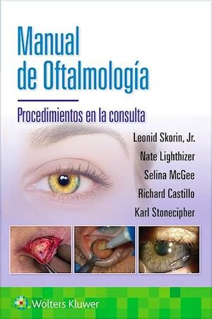 MANUAL DE OFTALMOLOGIA