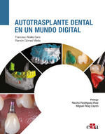 AUTOTRASPLANTE DENTAL EN UN MUNDO DIGITAL
