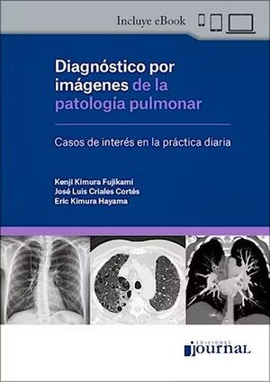 DIAGNOSTICO POR IMAGENES DE LA PATOLOGIA PULMONAR