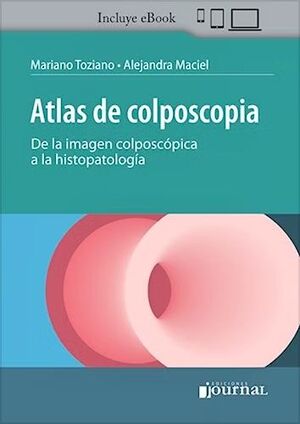 ATLAS DE COLPOSCOPIA